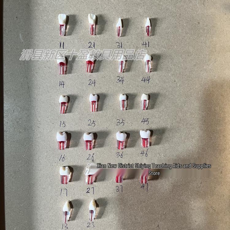 Dental Student Practice Resin Tooth: Access Cavity, Pulp Chamber, Root Canal, and Cavity Preparation Model