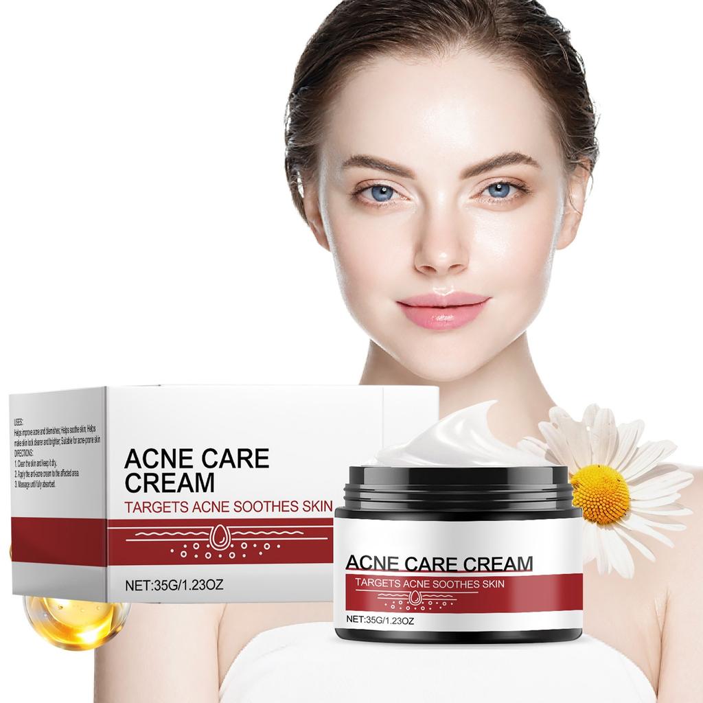 Acne Cream 35g Intensive Acne Cream To Reduce Pimples And Pimples, Suitable For All Skin Types And Ages
