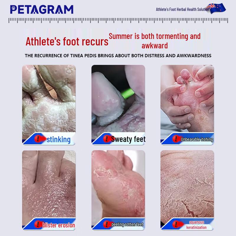 PETAGRAM Athlete's Foot Spray