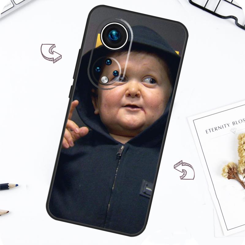 Funny Hasbulla Case For Honor Magic 7 5 6 Lite Honor 200 Pro X8b X9a X8a X8 X9 X9c X9b 50 70 90 Lite Cover