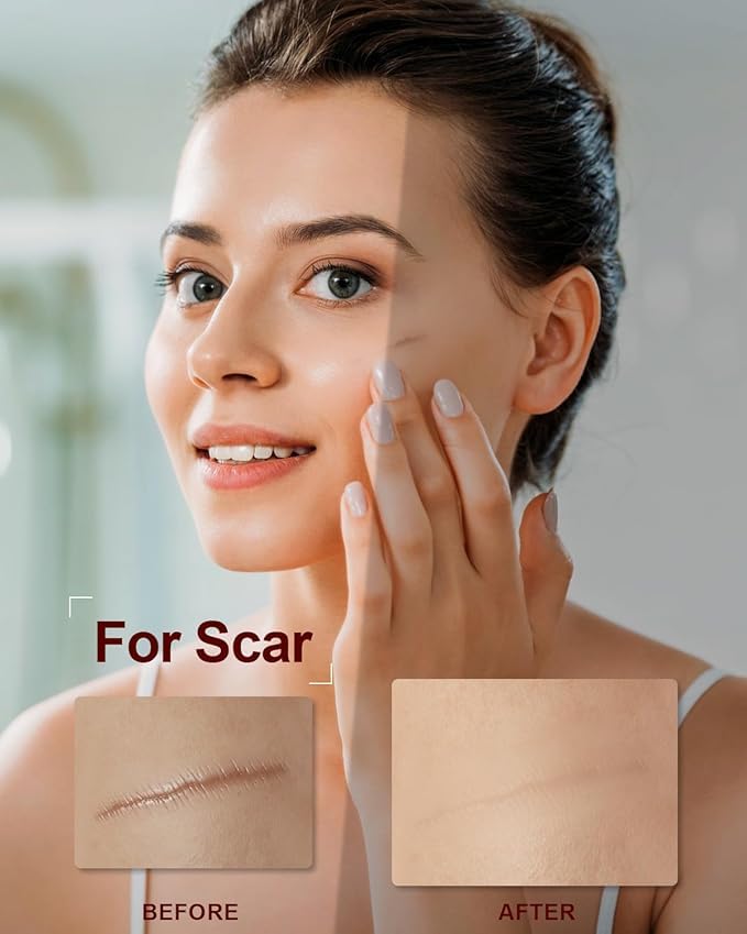 STYLEFLOW Rosehip Oil, 100% Pure Organic Cold-Pressed, for Wrinkles, Fine Lines, Scars, Stretch Marks, Under Eye and Curly Hair, 30ml (., Pack of 3)