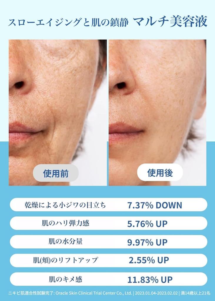 Klairs Midnight Blue Youth Activating Drop Serum for Troubled Skin Skin Delicate Moisturizing Korean Cosmetics (20ml) - Anti-aging, Elasticity, EGF,