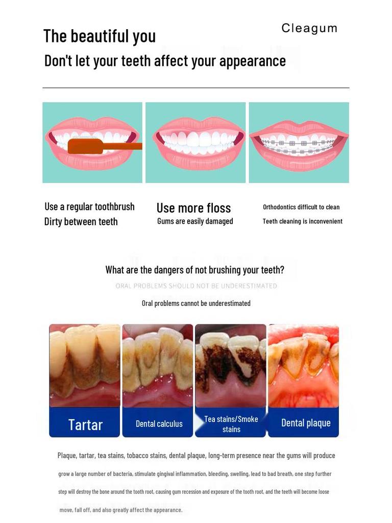 Portable Ultrasonic Electric Tooth Cleaner for Whitening and Tartar Removal at Home
