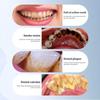 USB Charging Electric Teeth Cleaner Waterproof Dental Calculus Remover  Plaque Removal