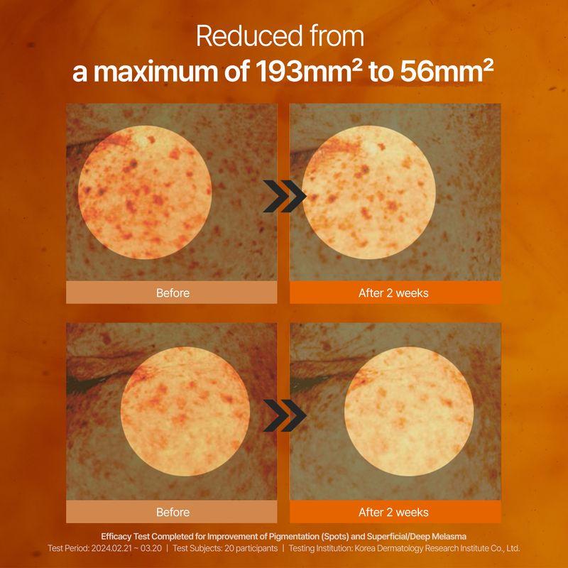 [shaishaishai] Caffeine Shot Blemish Toning Serum 30ml