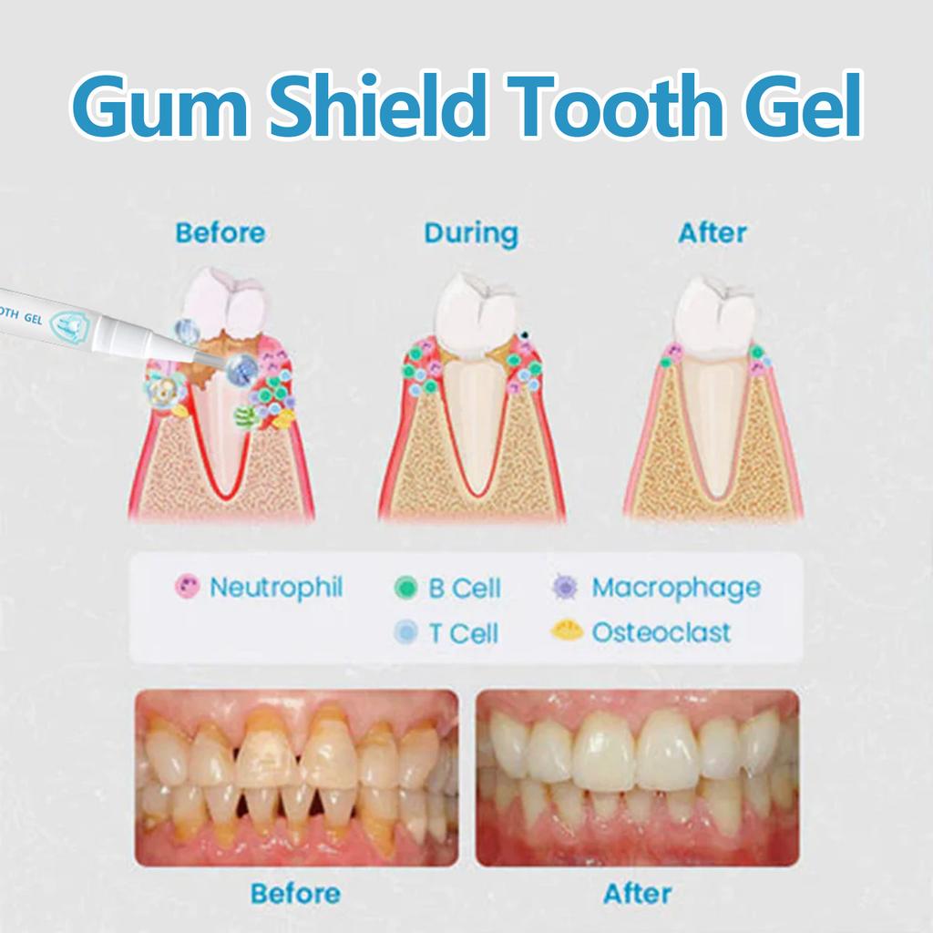 EELHOE Gum Oral Gel Pen – Clean Stains, Soothe Gums, Whiten Teeth,Oral Care 2ml