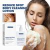 Jaysuing Spot Cleanser Lotion 150ml For Deep Facial And Body Cleansing To Brighten And Fade Spots