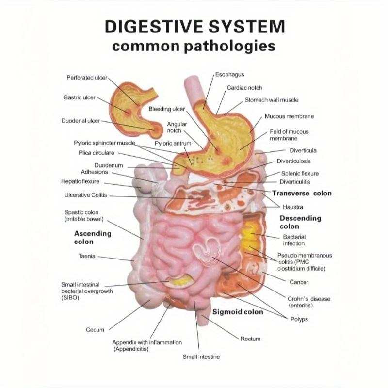 Human Digestive System Model Stomach Anatomy Large Intestine Cecum Rectum Duodenum Human Internal Organs Structure Model