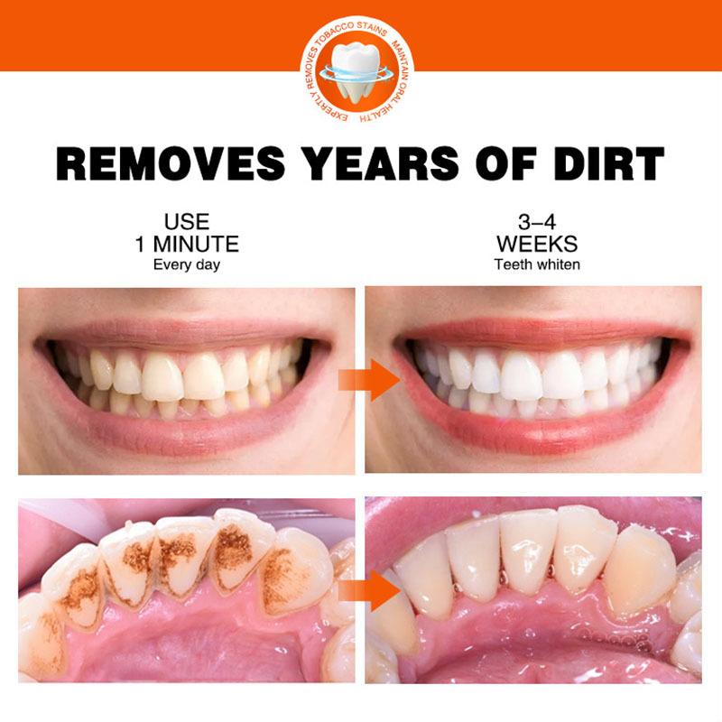 Effective and Powerful Vitamin C Toothpaste for Deep Cleaning and Stain Removal