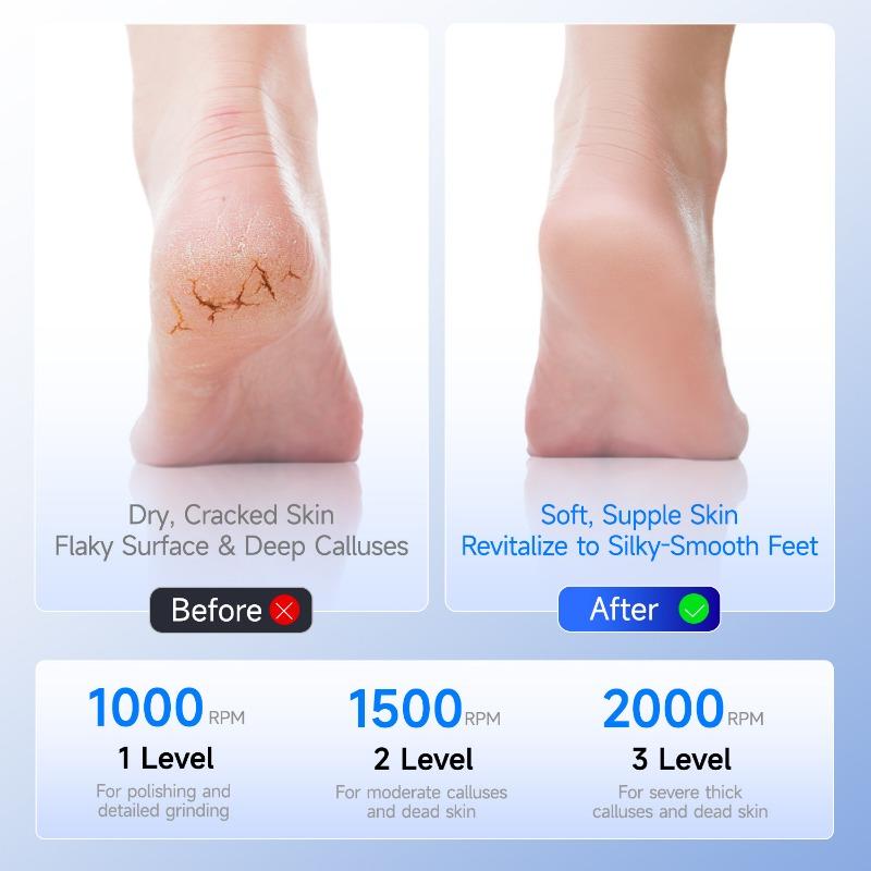 1PACK electric foot grinder, dead skin remover, pedicure, fully automatic and efficient foot grinding and foot skin rubbing artifact