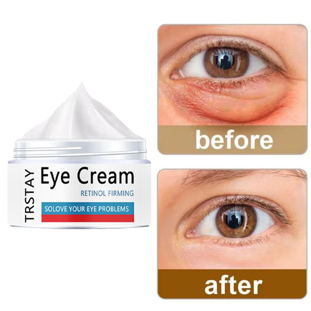 Eye Cream Adrenaline Strengthens and Cares for the Skin Around the Eyes, Whitening and Brightening the Skin, Hydrating and Moisturizing Eye Cream