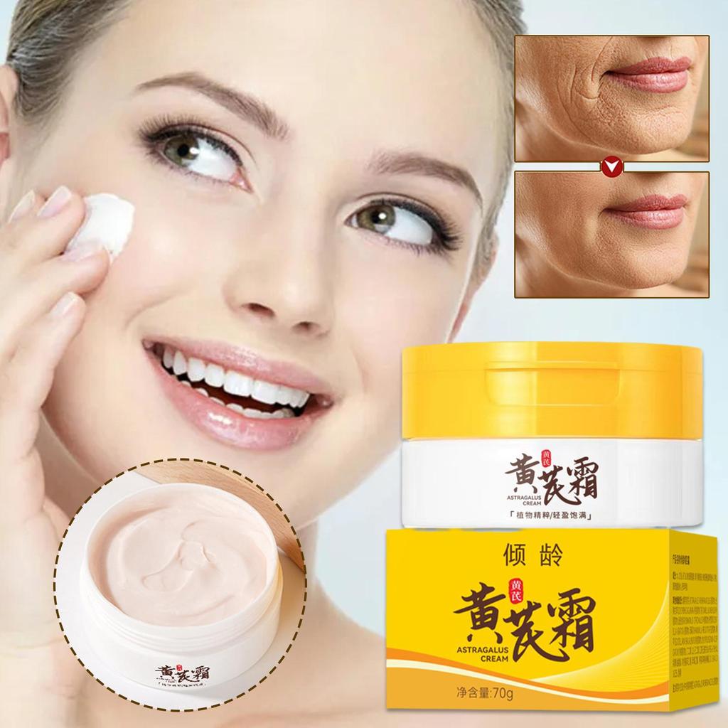 Chinese Astragalus Whitening Freckles Cream Remove Lightening Brighten Dark Spot Dry Face Care R8V8