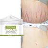 Moisturizing care cream, stretch mark repair cream