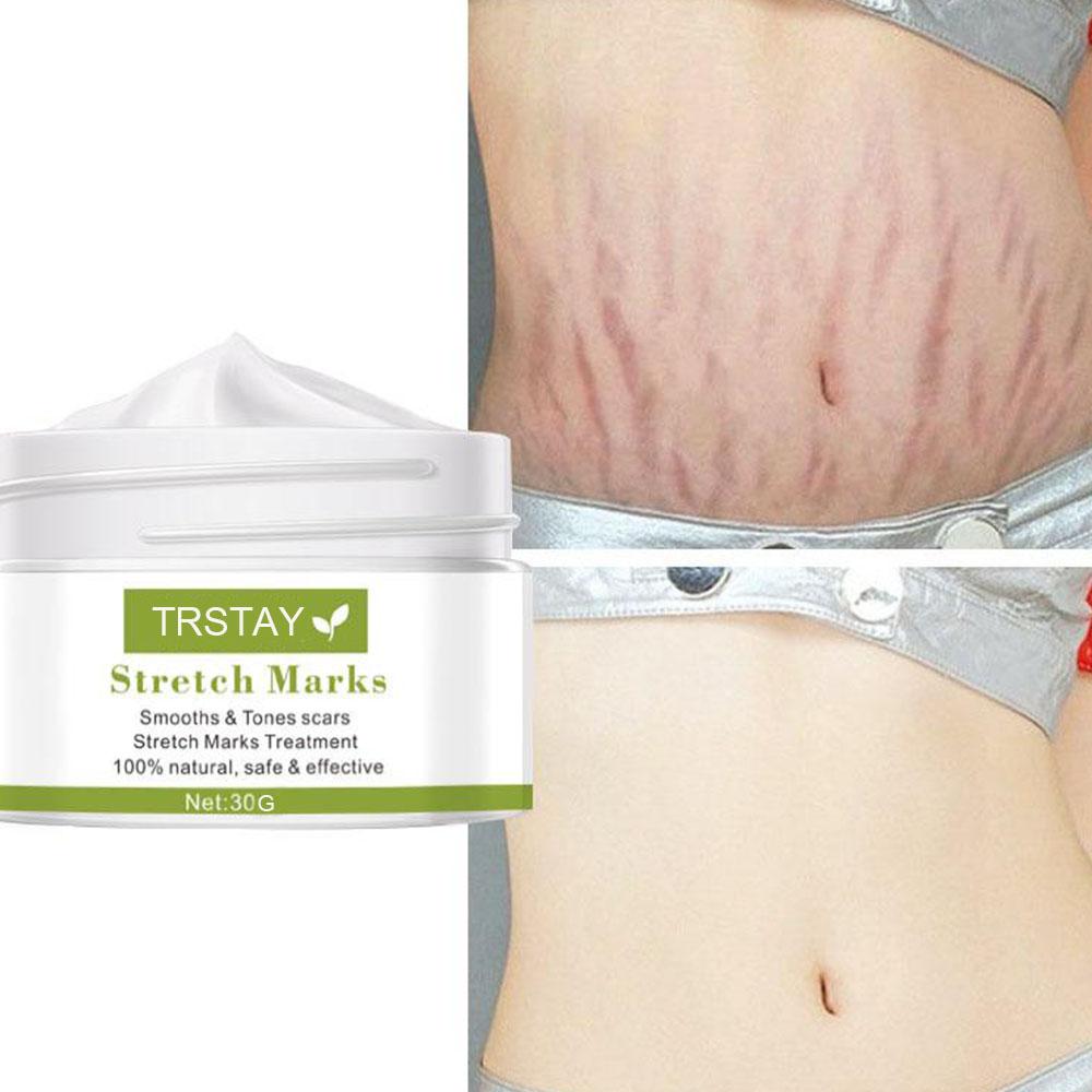 Moisturizing care cream, stretch mark repair cream