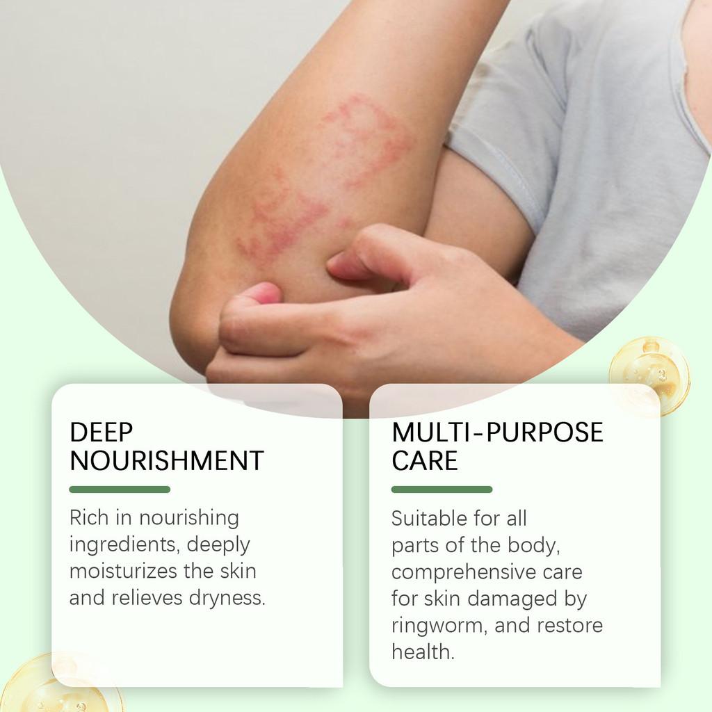 Ximonth Skin Repair Cream Gentle Nourishing Formula For Enhanced Comfort 30g