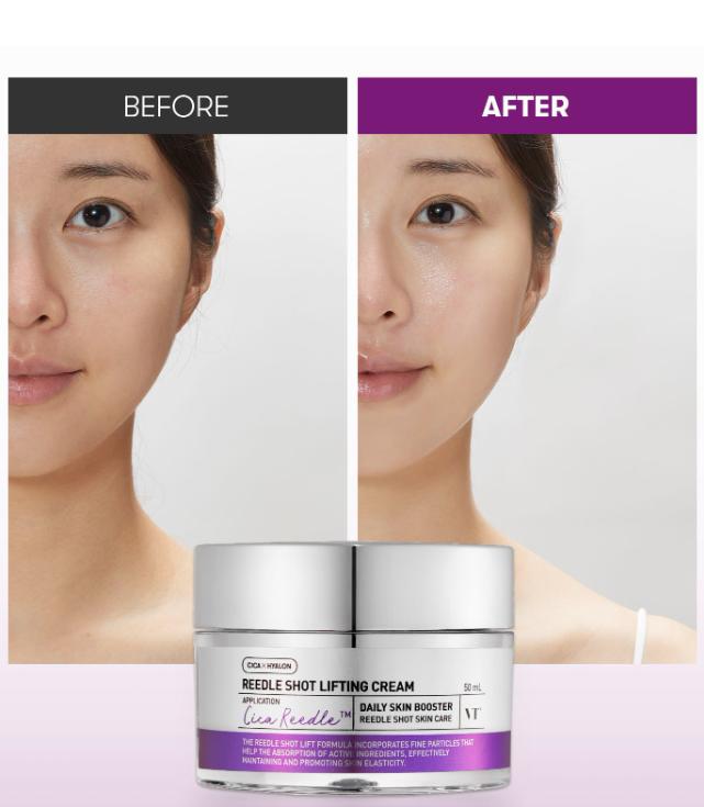 VT Cosmetics Reedle Shot Lifting Cream 50ml
