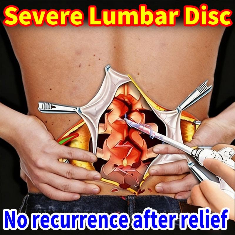 Targeted Lumbar Disc Cream - Post-Rehabilitation Care for Post-Surgery Patients