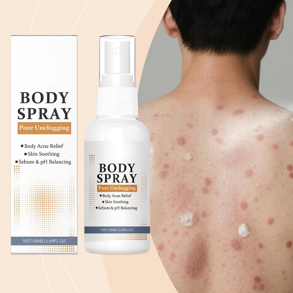 Kroppsaknespray for akne på ryggen, kroppsspray hudberoligende spray;  Urtehudspray,50ml