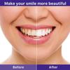 V34 Teeth Whitening Toothpaste Cleans Teeth Stains, Protects Gums, Whitens Teeth, Oral Care Toothpaste 30ml