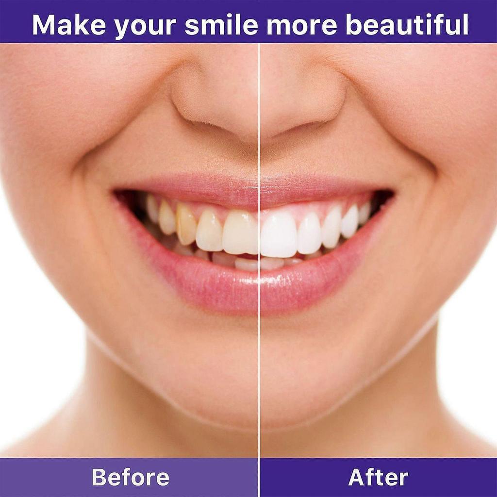 V34 Teeth Whitening Toothpaste Cleans Teeth Stains, Protects Gums, Whitens Teeth, Oral Care Toothpaste 30ml