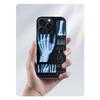 Medizinische menschliche Organe Gehirn Capa Handyhülle Für Iphone 17 Air 16 Pro Max 15 12 Pro 14 Plus 17E 16E 11 13 Mini Hüllen Fundas