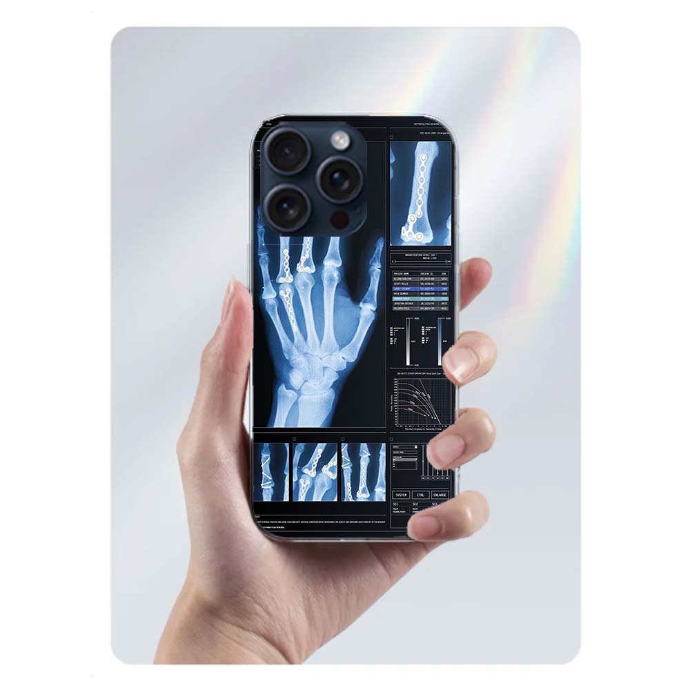 Medizinische menschliche Organe Gehirn Capa Handyhülle Für Iphone 17 Air 16 Pro Max 15 12 Pro 14 Plus 17E 16E 11 13 Mini Hüllen Fundas