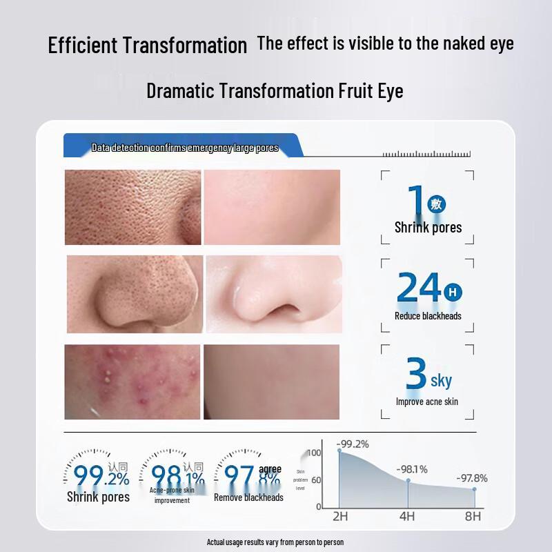 Jiaoboshi Porenverfeinernde & Aknebehandelnde Gesichtsmaske