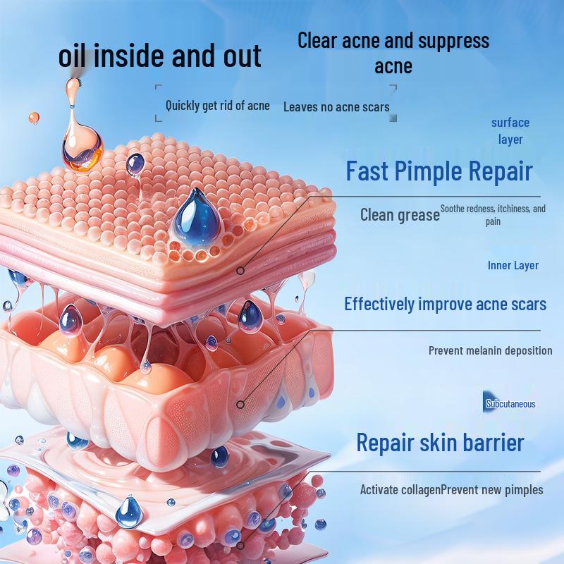 BEAUTY NOTES Teen Skincare for Acne & Blemishes