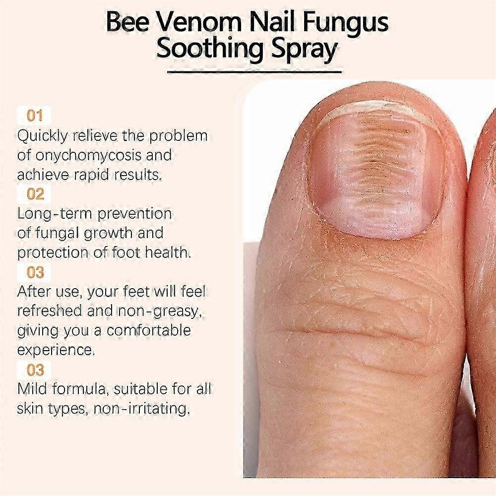 Suitable for Nail Repair Serum, Bee Venom Care Spray, Ingrown Toenail Solution