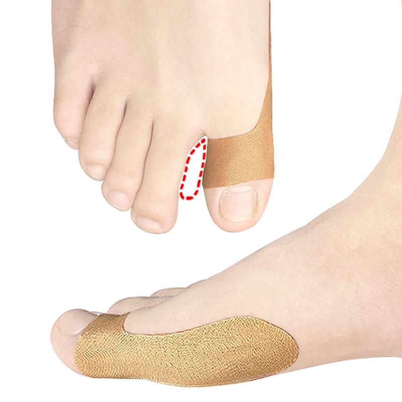 2/10/20Pcs Daumen Korrektur Patch Big Toe Corrector Adjuster Finger Toe Patch Protector Orthopädische Aufkleber