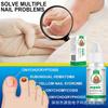 SUAI Nail Fungus Repair Liquid - Toenail Fungus Treatment, Antifungal Solution for Nail Bed, Cuticle Care, Portable Clear Liquid 30ml