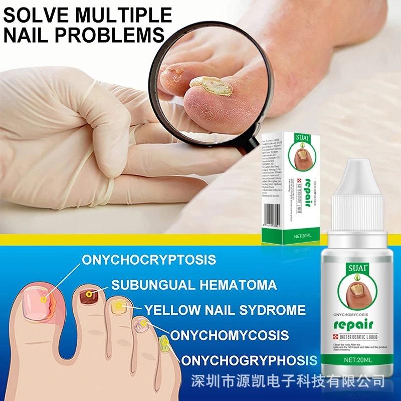 SUAI Nail Fungus Repair Liquid - Toenail Fungus Treatment, Antifungal Solution for Nail Bed, Cuticle Care, Portable Clear Liquid 30ml