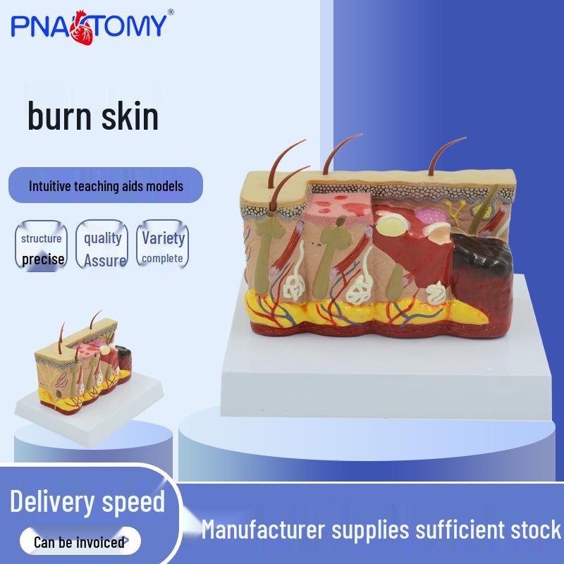 Burned Skin 3D Simulation Model: Medical Human Skin Structure Teaching Aid 16.5x13x11 cm