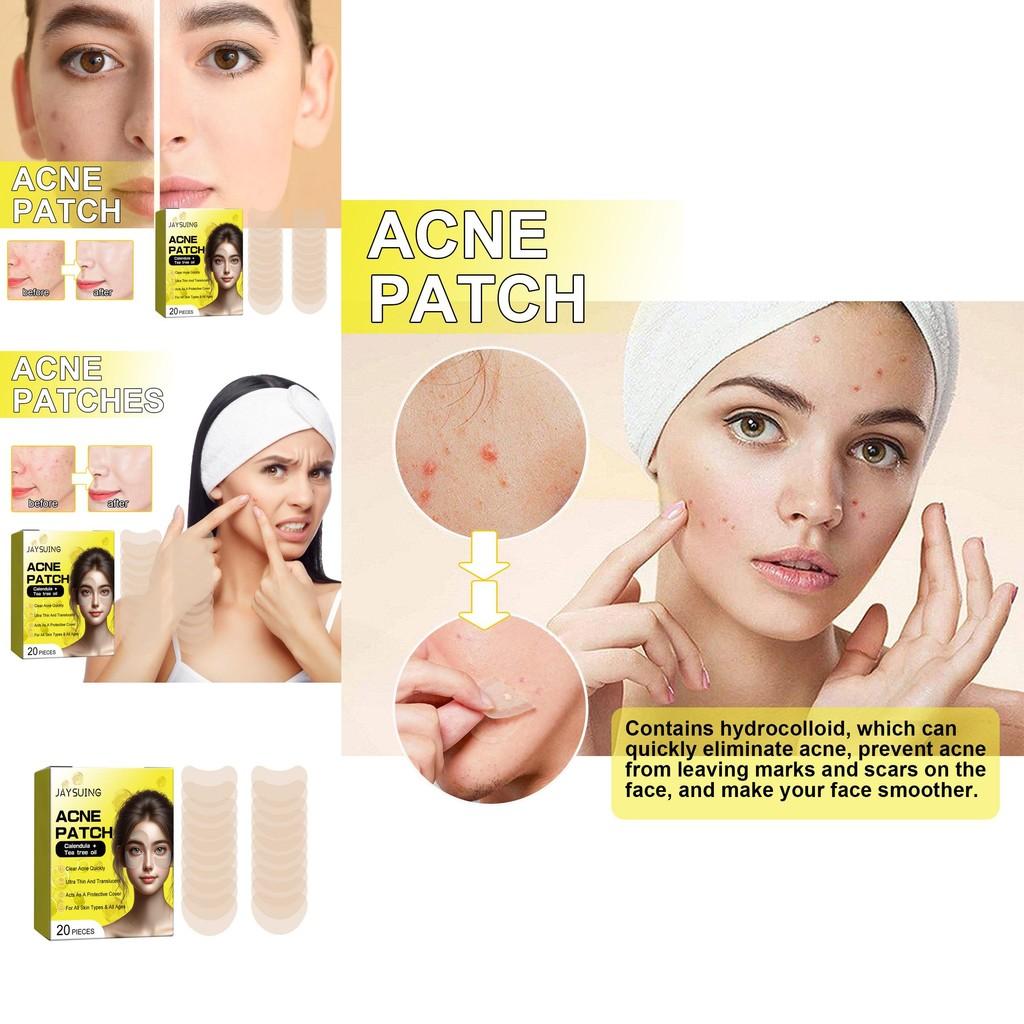 Jaysuing Acne Patches For Clear Skin 20pcs Effective Blackhead Removal Treatment
