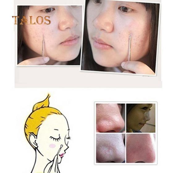 5 Pcs Women Professional Blackheads Remover Extractor Acne Comedone Facial Tool Skin Care