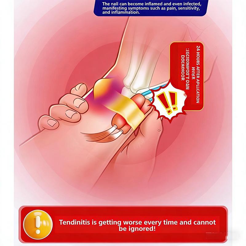 Thumb-Specific Tendonitis Care: Eases Sore Joints Fast