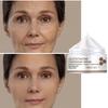 Retinol Brightening Anti-Aging Cream, Slows Down Collagen Loss, Rejuvenates the Skin, Reduces Wrinkles, and Is Anti-aging