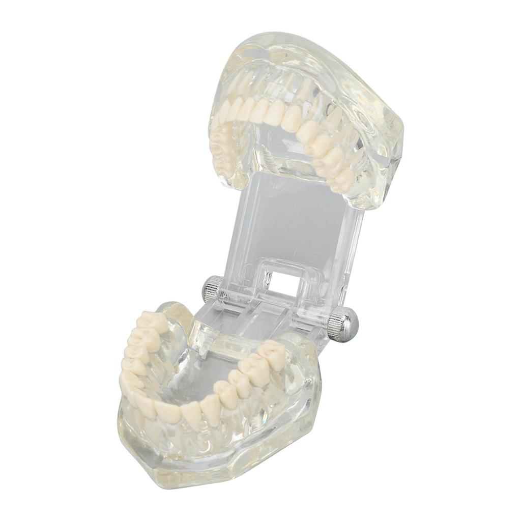 Transparent Dental Model Clear Structure Educational Dental Teeth Display Model for Dental Clinic