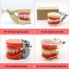 Dental Educational and Communication Model Set: Comprehensive, Removable, and Implant Restoration Models