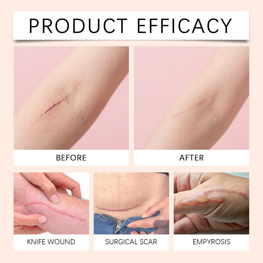 The Imprinting Light Moisturizing Patch Is A Daily Care Patch For Body Skin, Blemishes And Moles.