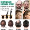 Biotin hair growth spray anti hair loss fast regeneration scalp treatment essence