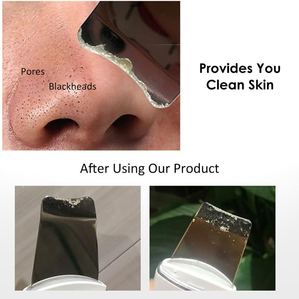 Vibrate Face Clning Device Skin Scrubber Face Lifting Peeling Clner