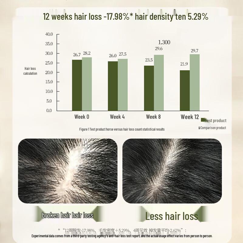 Bawang Anti-Dandruff & Anti-Hair Loss Shampoo