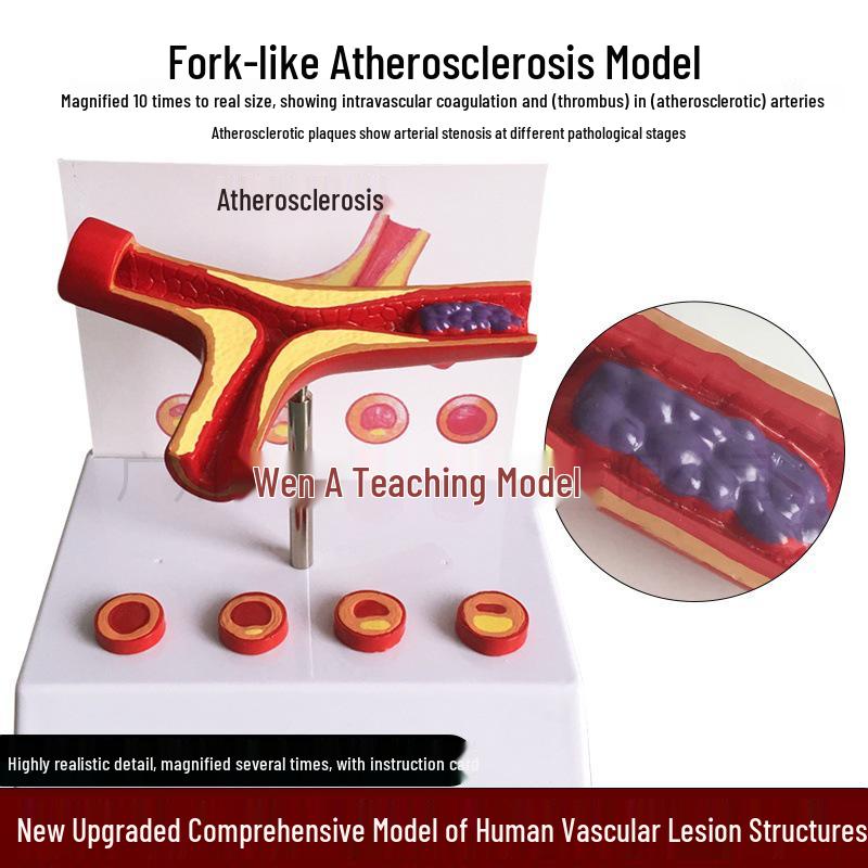 Dynamic Blood Vessel Model for Teaching Atherosclerosis and Thrombus Formation