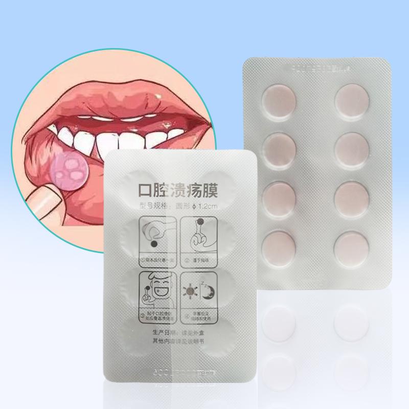 Szybka Pielęgnacja Plaster na Owrzodzenia Jamy Ustnej Opatrunek na Rany Jamy Ustnej Do Aft Szybka Ulga w Bólu Lek na Afty Środek Przeciwbólowy