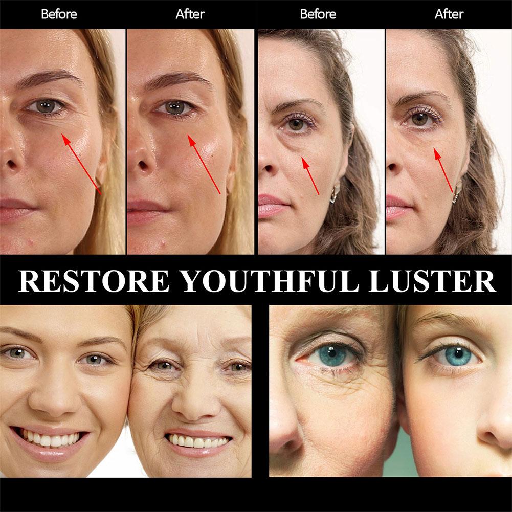 Okamžité odstranění očních váčků Krém, Retinolový krém, Proti otokům, Vráskám, Stárnutí, Stahuje kruhy, Oddaluje Redukuje Tmavý Gel