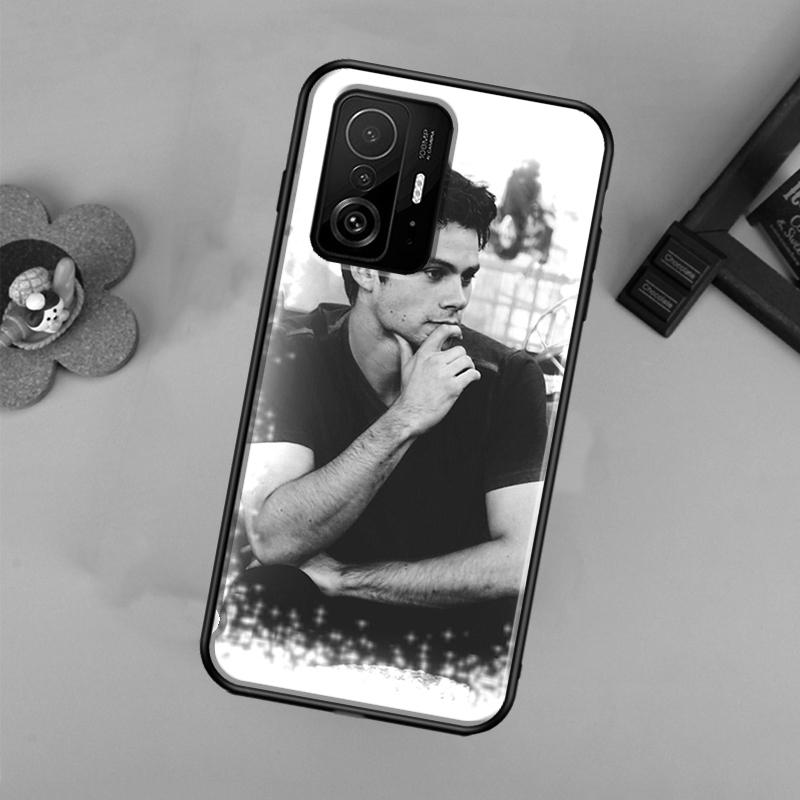 Teen Wolf Dylan Obrien Case For Xiaomi POCO X7 X6 Pro X3 X5 M6 F3 F5 F6 Pro 11T 12T 13T 14T Pro 13 14 Ultra Cover