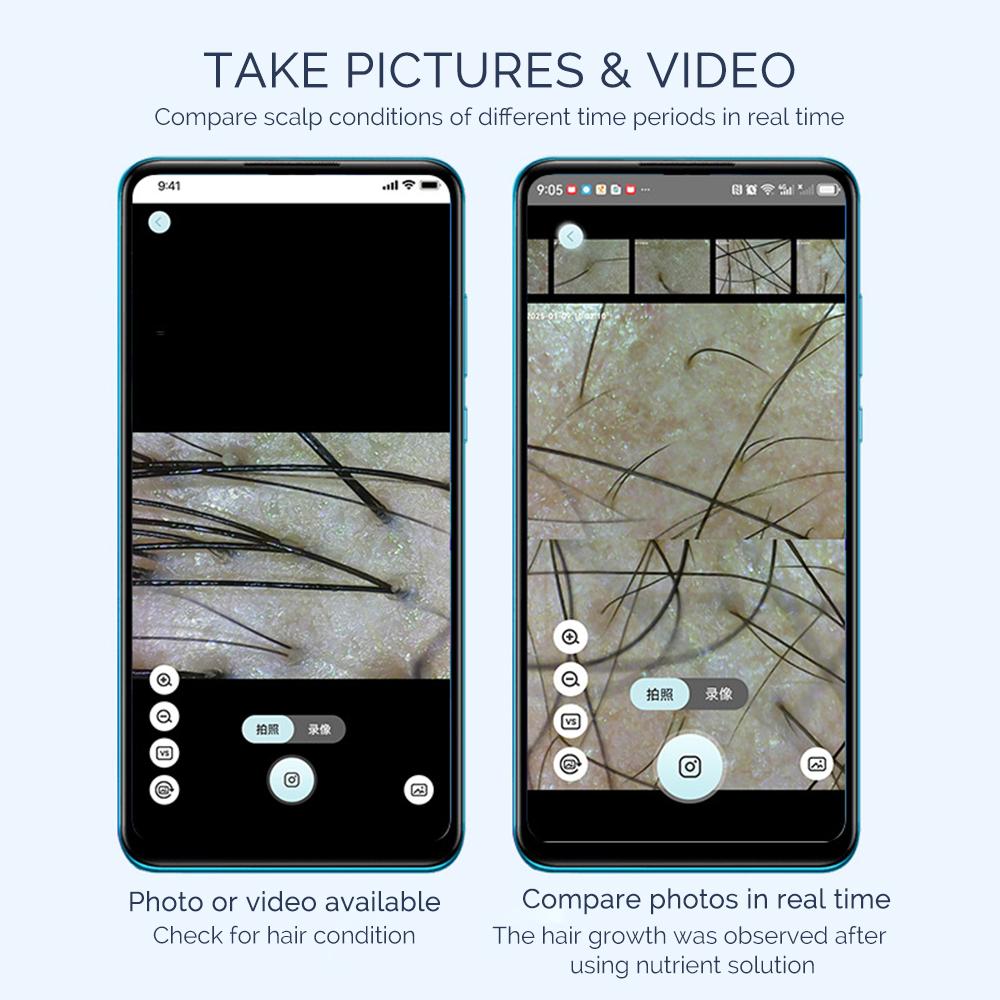 50X/200X Magnifying Mini Hair Follicle Scalp Detector Portable Skin And Hair Eetector Skin Tester Skin Analyzer Pore Magnifier