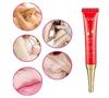 Digitalzap® Cherry Berry | Intimate Area Brightening Cream for Women | Bikini Line Dark Spot Corrector | Skin Tone Even & Glow Cream | Underarm, I