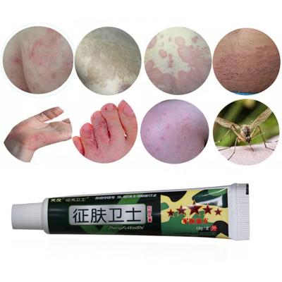 15g Herbal Ointment Antibacterial Relieve Itching Skin Problems Treatment Cream